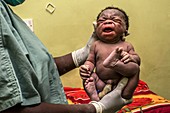 Baby born by caesarean section