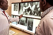 Hospital doctors examining X-rays