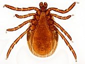 Male Lyme disease tick, light micrograph