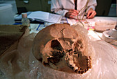 Analysis of prehistoric skull from the Cova des Pas site