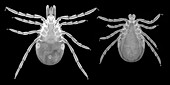 Lyme disease ticks, light micrograph