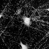 Motor neurones, light micrograph