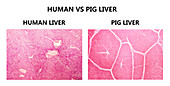 Human and pig livers, micrograph