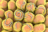 Threadworms in the gut, illustration