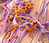 Faecal bacteria, SEM