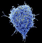 HIV infected cell, SEM