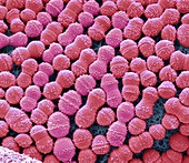 Streptococcus mutans, SEM