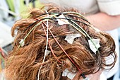 Electroencephalography electrodes attached to scalp
