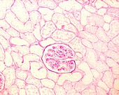 Kidney basement membranes, light micrograph