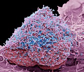 HIV infected cell, SEM