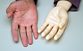 Artificial hand and human hand