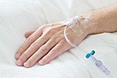 Patient's hand with cannula
