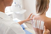 Patient undergoing a patch test in allergy clinic
