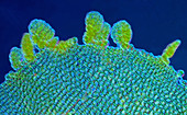 Liverwort leaf, light micrograph