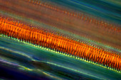Asparagus (Asparagus officinalis) stem, light micrograph