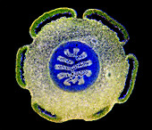 Clubmoss (Lycopodium sp.) stem, light micrograph