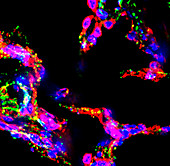 Lung alveoli, fluorescence micrograph