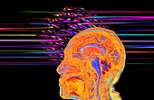 Human brain abstract, 3D MRI scan