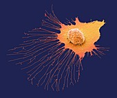 Migrating breast cancer cell, SEM