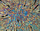 Nicotinic acid crystals, polarised light micrograph
