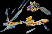 Glutamine crystals, light micrograph