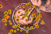 HIV infecting human embryo, conceptual illustration
