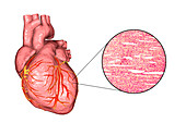 Human heart and cardiac muscle, composite image