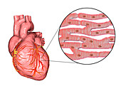 Human heart and cardiac muscle, illustration