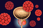 Viral etiology of prostate cancer, conceptual illustration