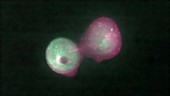 Dividing cancer cell, fluorescent microscopy