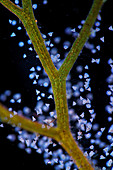 Vorticella ciliates on bladderwort plant, light micrograph