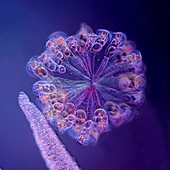 Colonial rotifers and hydra tentacle, light micrograph