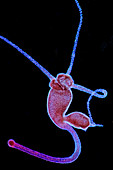 Hydra budding, light micrograph