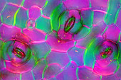 Peperomia plant stomata, light micrograph
