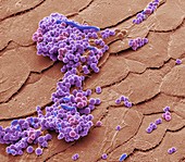Folliculitis bacteria, SEM