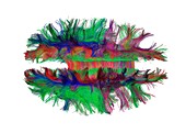 Brain fibres top view, DTI scan