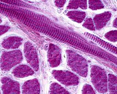 Striated skeletal muscle fibres, light micrograph