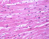 Cardiac muscle fibres, light micrograph