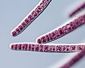 Stylonema sp. red alga filaments, light micrograph