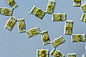 Tabellaria freshwater diatoms, light micrograph