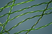 Desmidium swartzii algae filaments, light micrograph