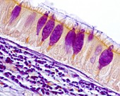 Trachea and oesophagus, light micrograph