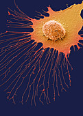 Migrating breast cancer cell, SEM