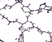 Alveolar reticular fibres, light micrograph
