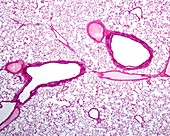 Lung parenchyma, light micrograph