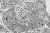 Pancreatic acinar cells, TEM