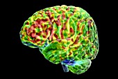 Human brain's left hemisphere, fMRI scan