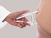 Doctor measuring body fat