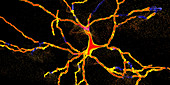 Degeneration of a neuron, conceptual illustration