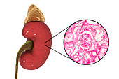 Human kidney, illustration and micrograph